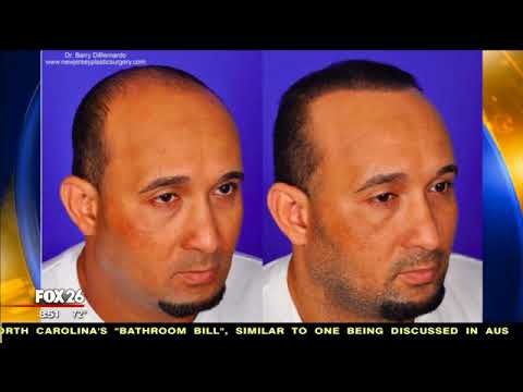 SmartGraft Hair Restoration- Dr. Nikko on Fox