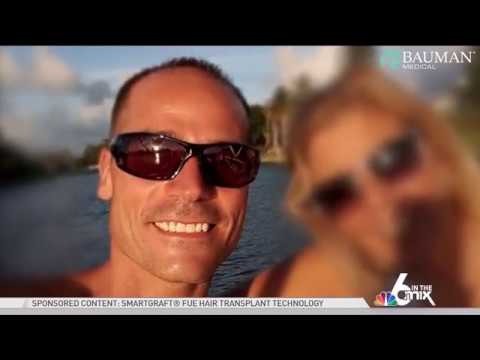 Brian's SmartGraft Hair Transplant on NBC6 Miami